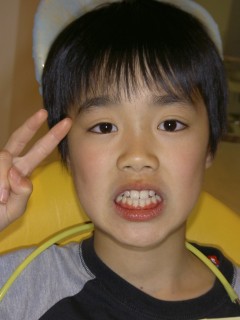 SHOFU DENTAL DIGITAL CAMERA