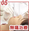 無痛治療